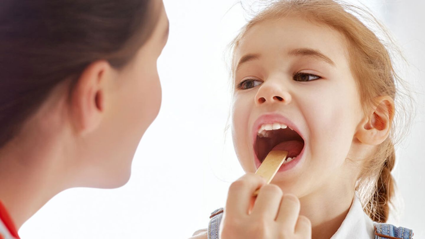 Top Signs Your Child Needs a Frenectomy