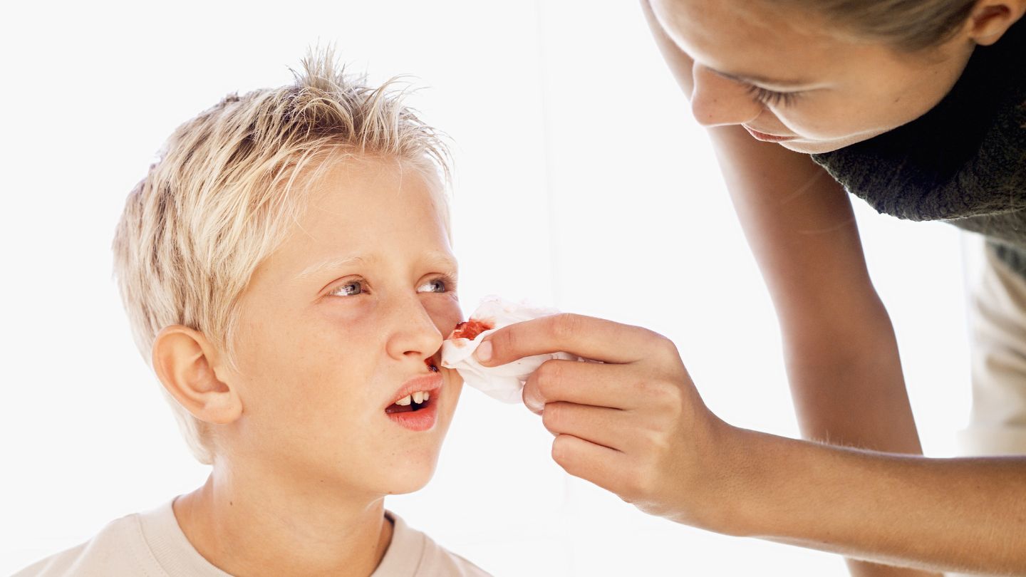 Understanding What Causes Nose Bleeding in Children